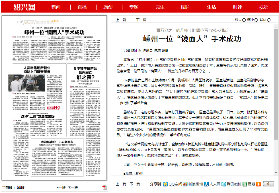 【绍兴晚报】百万分之一的几率！脏器位置与常人相反 嵊州一位“镜面人”手术成功