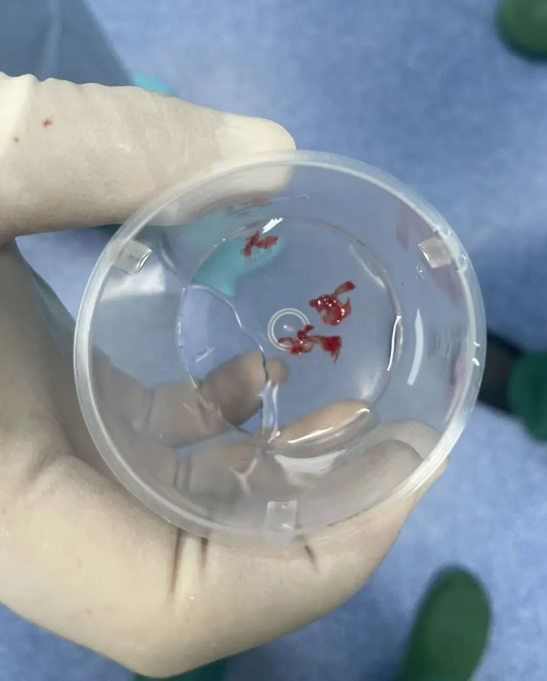 生命至上！外地司机突发脑梗死 “卒中绿色通道”高效救治