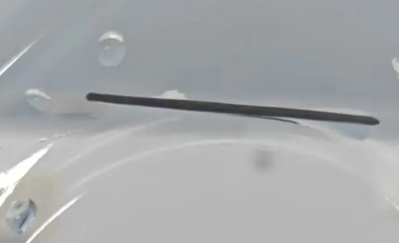 惊险！误吞3厘米铁丝刺穿胃壁后......