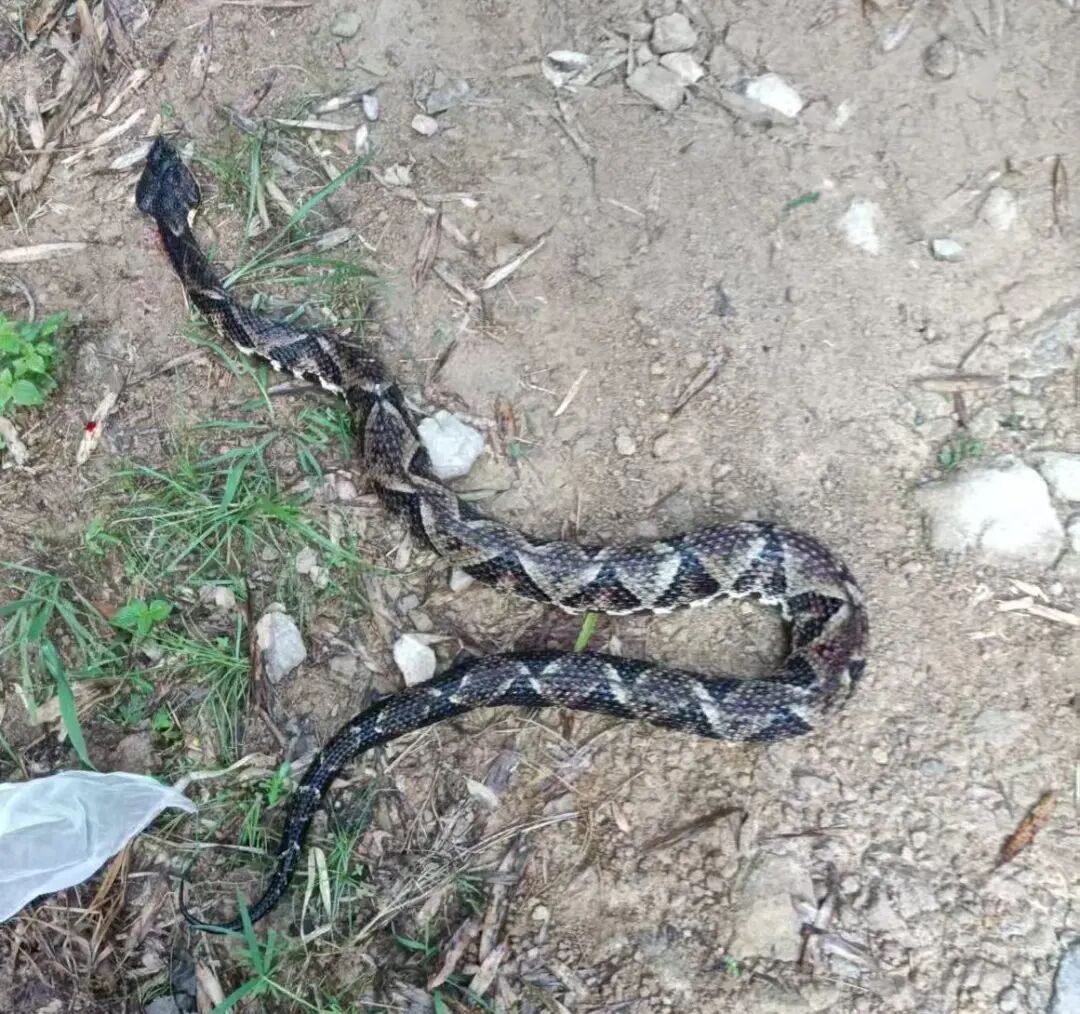 头条丨当心“蛇出没”！我院接诊今年首例蛇咬伤患者