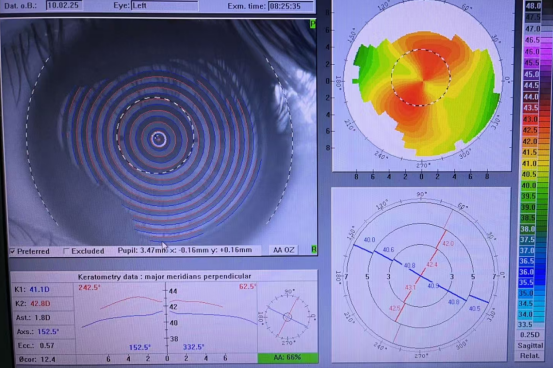 春季眼痒别硬扛！16岁高中生一个动作，差点毁掉视力……
